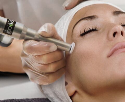 Procell Microchanneling treatment
